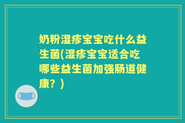 奶粉宝宝吃什么益生菌(宝宝适合吃哪些益生菌加强肠道健康?) 奶粉宝宝吃什么益生菌(宝宝适合吃哪些益生菌加强肠道健康?)