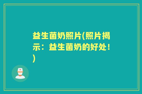益生菌奶照片(照片揭示:益生菌奶的好处!) 益生菌奶照片(照片揭示:益生菌奶的好处!)